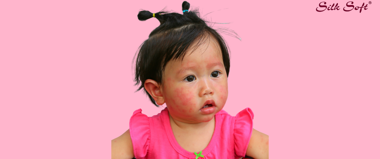 Say Goodbye to Rashes: Wet Wipes for Newborns That You Must Have